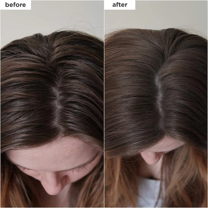 Shampoo Briogeo Seco de Carvão e Biotina Revitalizante do Couro Cabeludo