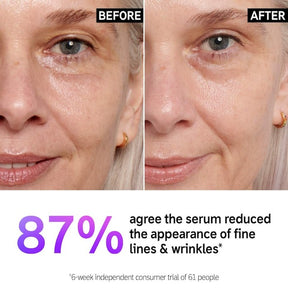 The INKEY List Retinol Fine Lines and Wrinkles Serum 1 Oz / 30 mL