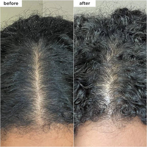 Exfoliante Micro-exfoliante para el Cuero Cabelludo Briogeo con Carbón y Aceite de Coco Scalp Revival 8oz
