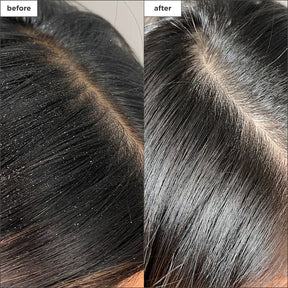 Spray Detoxificante para Acumulación de Residuos Scalp Revival™ Briogeo con Carbón y Árbol de Té 4oz