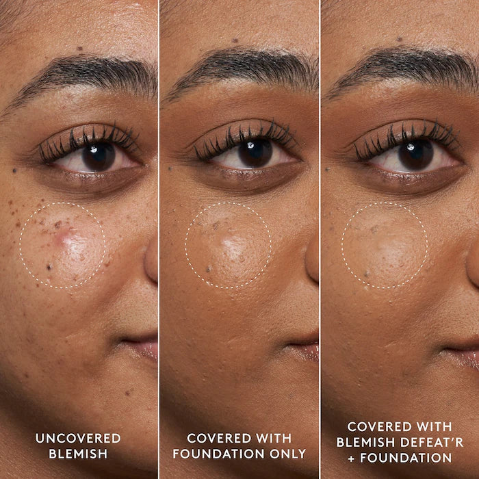 Gel de Tratamento Localizado para Espinhas Blemish Defeat'r da Fenty Beauty, 15 ml
